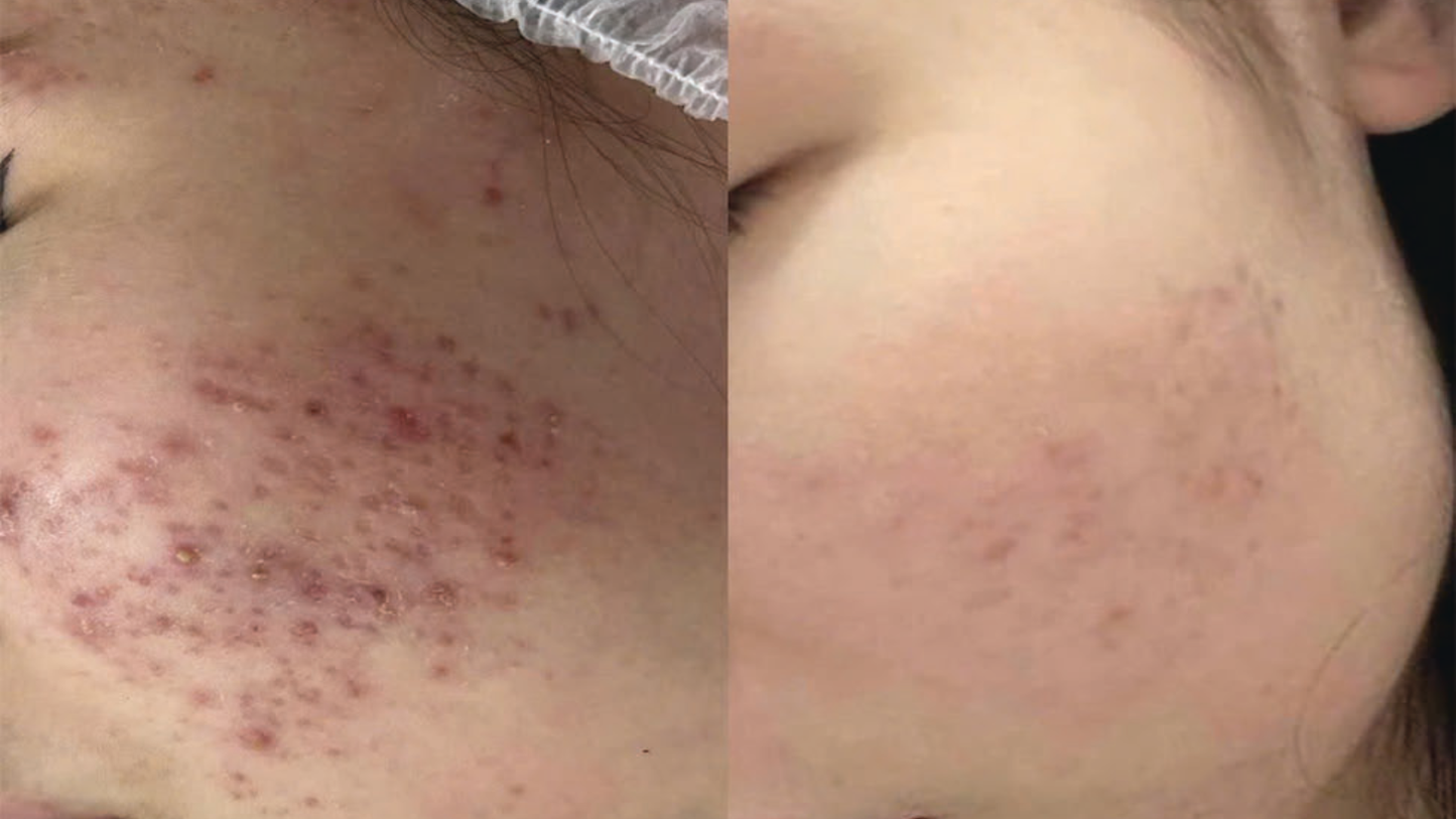 Longevity Korea Glass Skin Online Course