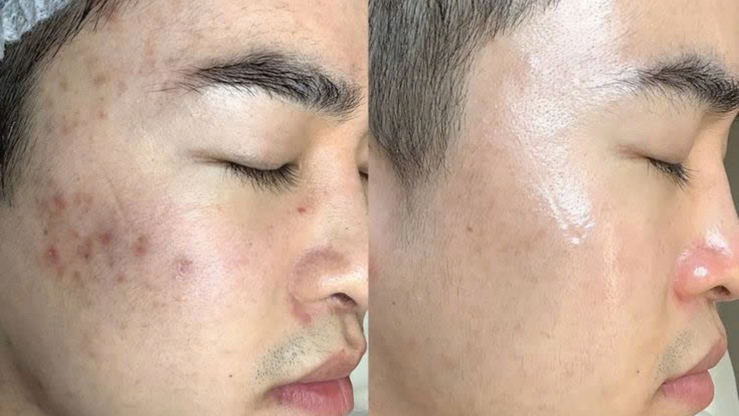 Resa’mon | Rejuvenating DNA Ampoule (PDRN 50,000ppm)