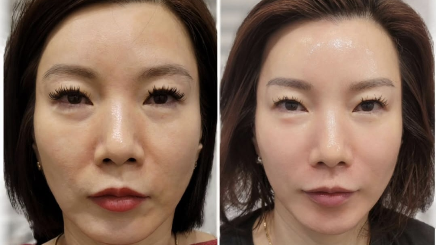 Longevity Korea Glass Skin Online Course