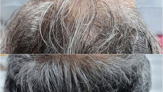 EXO HAIR  Scalp Vitality & Hair Strength Booster | Professional Cosmetic Skincare