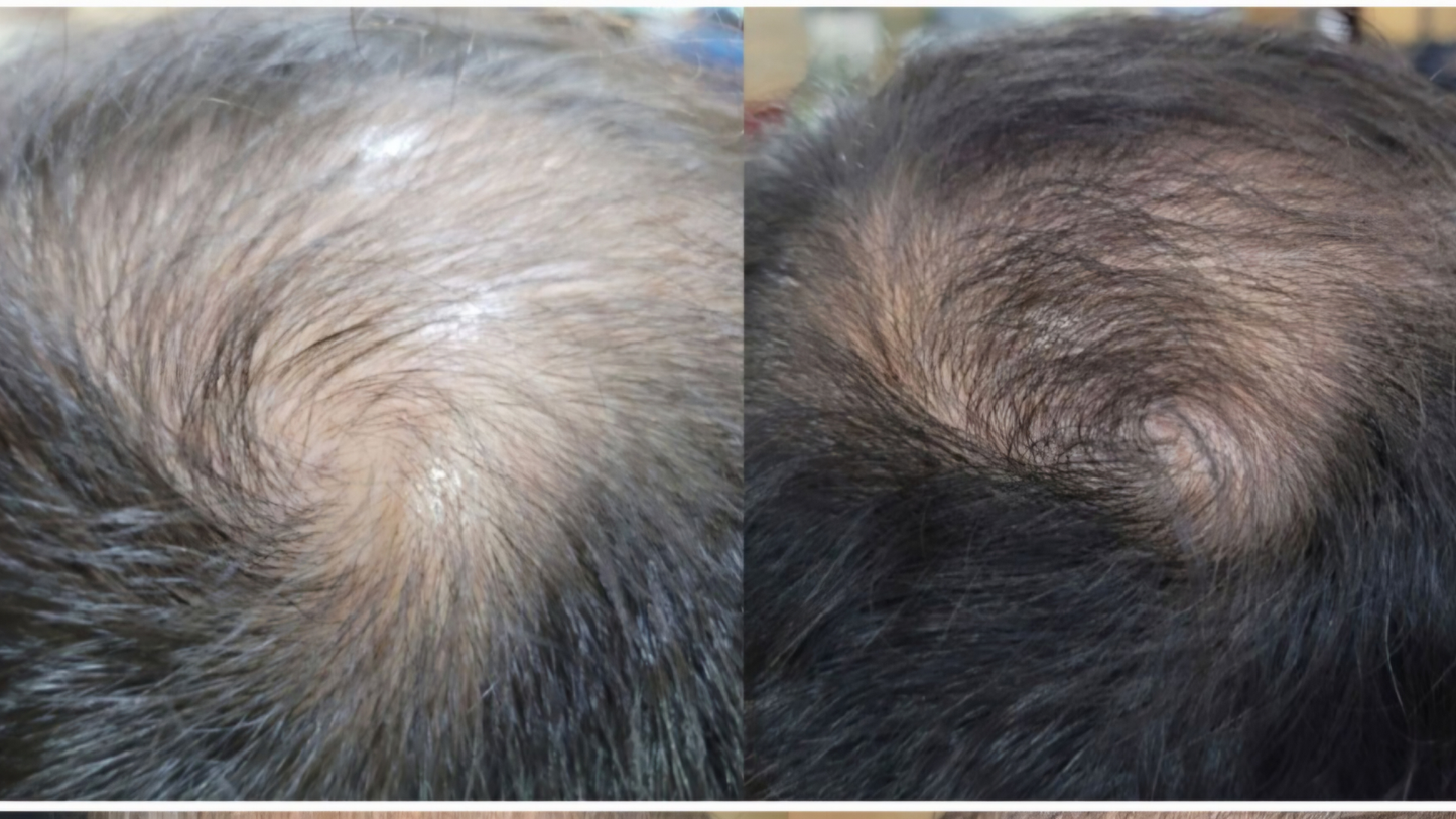 Resa’mon | Rejuvenating DNA Ampoule (PDRN 50,000ppm)