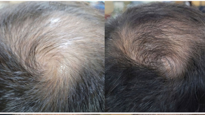 Resa’mon | Rejuvenating DNA Ampoule (PDRN 50,000ppm)