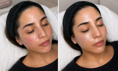 Longevity Korea Glass Skin Online Course
