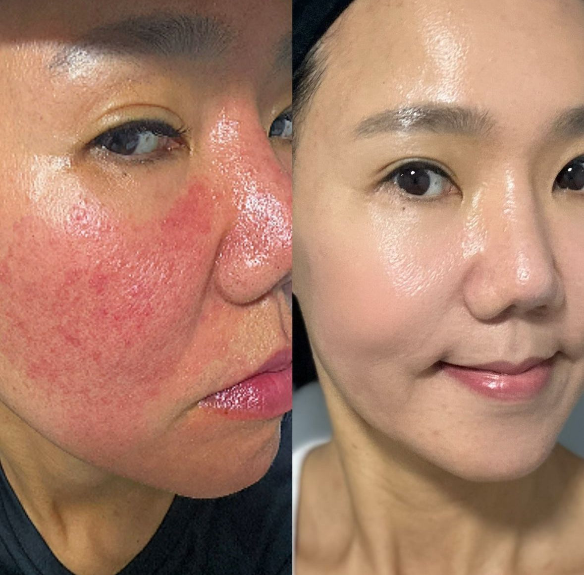 EXO SS Booster | Advanced Skin Renewal Booster