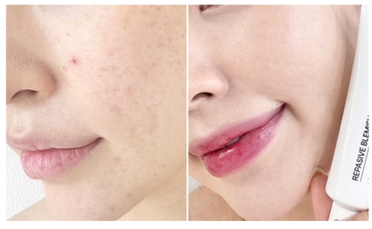 CELL29 | REPASIVE BLEMISH BALM | Post-Treatment BB Cream