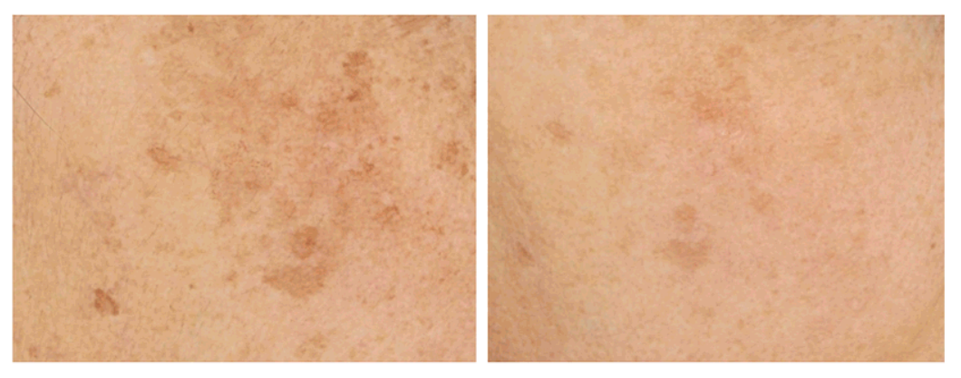 CELL29 | Luonlight Potency Cream